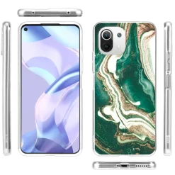 Xiaomi Mi 11 Lite 4G/5G - Marmor & Sand Design Hülle